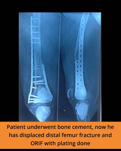 Top Orthopaedics Hospital in Erode