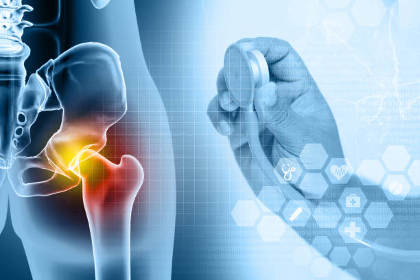 X ray of the hip joint and femur. 3d illustration
